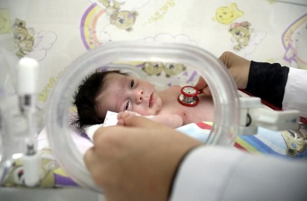 20 bin doğumda bir görülüyor! Muammer bebek tüm organları ters doğdu - Resim: 1