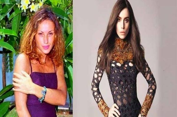 Pınar Altuğ şaşırttı! Ona bir de estetiksiz bakın - Resim: 3