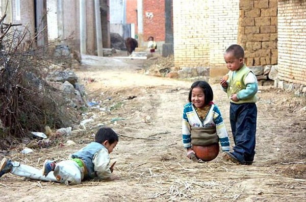 Onu en son böyle gördük birde yıllar sonraki haline bakın - Resim: 4