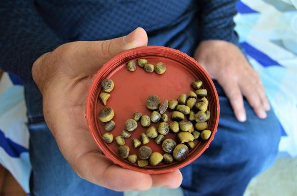 Aksaray'da oturamayacak hale geldi! Doktora gidince şok oldu: 50 tane... - Resim: 0