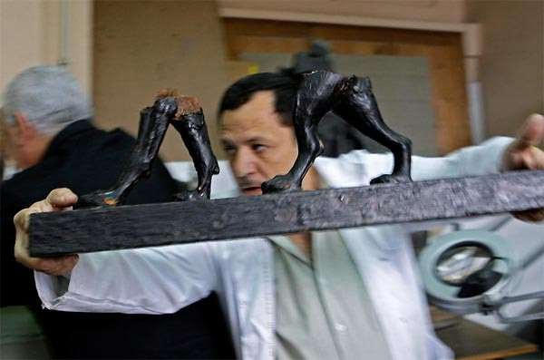 Firavunlar ameliyat masasında! - Resim: 2