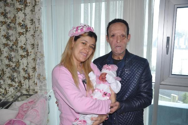 Yüz nakilli Recep Sert tutuklandı! - Resim: 1