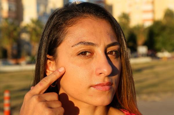 Şaka gibi olay! Milli judocu rakibinin babasından dayak yedi - Resim: 2