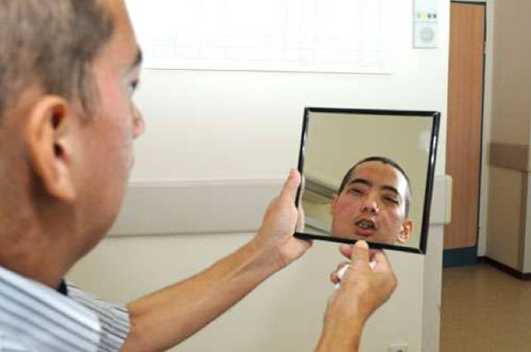 İşte 2. tam yüz nakli yapılan genç  - Resim: 1