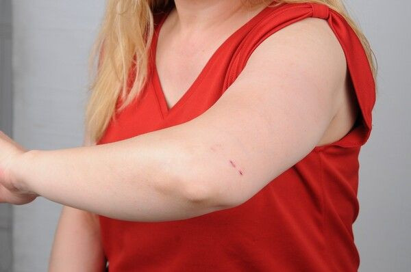 Gaziantep'te küfürler savurup kabusu yaşattı! Saçları avuç dolusu yolundu: Psikolojim çok bozuldu - Resim: 4