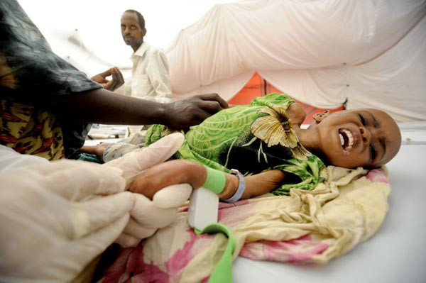 Türk doktorlar bayramda da Somali'de şifa dağıttı! - Resim: 1