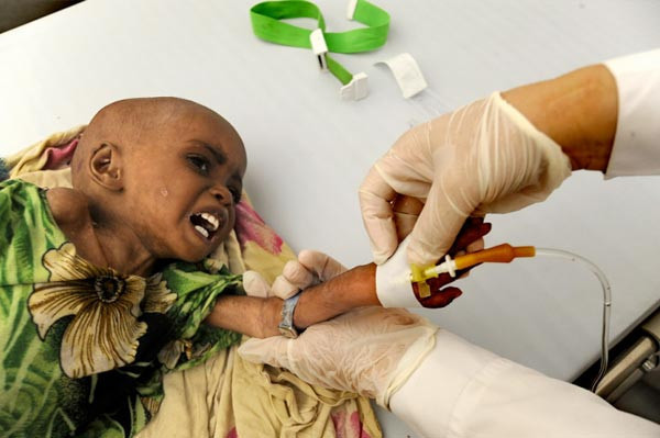 Türk doktorlar bayramda da Somali'de şifa dağıttı! - Resim: 2