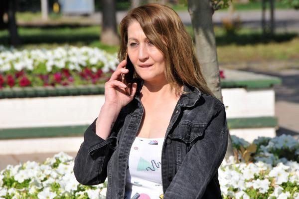 4 kez dolgu yaptırdığı alt dudağı koptu! Şimdi yeniden yaptırıyor - Resim: 4