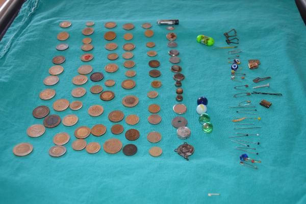 Çocukların yuttuğu şeylere bakın! Elazığ'da hastanede sergilendi - Resim: 1