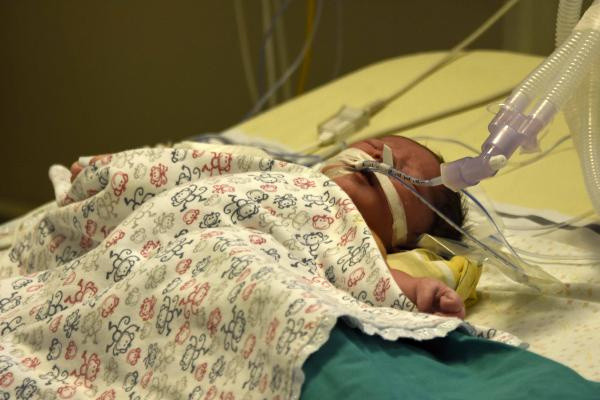 Kalbi delik olarak dünyaya geldi! 100 dakika kalbi durdurularak ameliyat edildi - Resim: 0