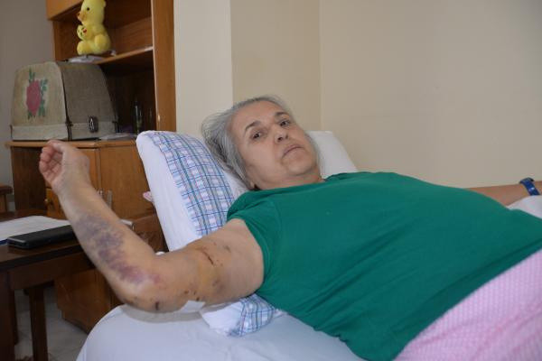 Mersin'de yürüyüş yaparken sokakta kabusu yaşadı: Ensemden ısırdılar - Resim: 0