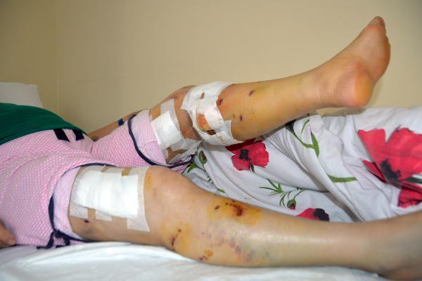 Mersin'de yürüyüş yaparken sokakta kabusu yaşadı: Ensemden ısırdılar - Resim: 1