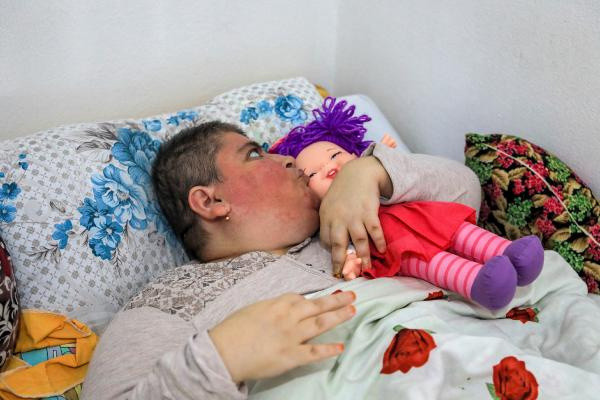 Antalya'da 7 yıldır yatağa bağımlı hale geldi! Tek bir isteği var - Resim: 1