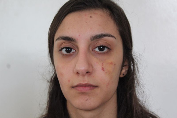 Gaziantep'te cenaze dehşet! Halası yüzünü ısırdı kaşları yırtıldı: Özel bölgelerimi açamadım - Resim: 1