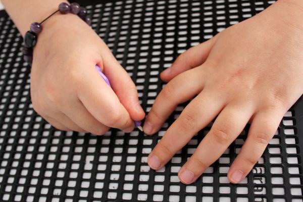 Antalya'da bacaktaki lekeyi görünce gerçek ortaya çıktı! Tek bir isteği var - Resim: 1