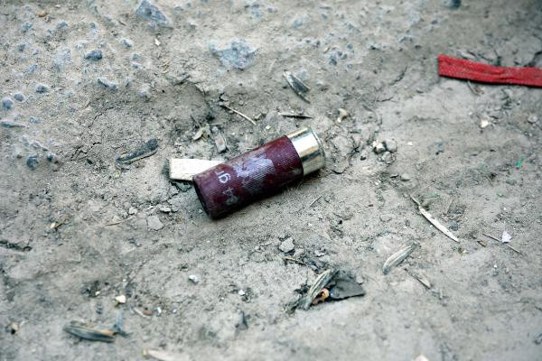 Gaziantep'te kavgada kan aktı! Baba oğul hastanelik oldu - Resim: 0