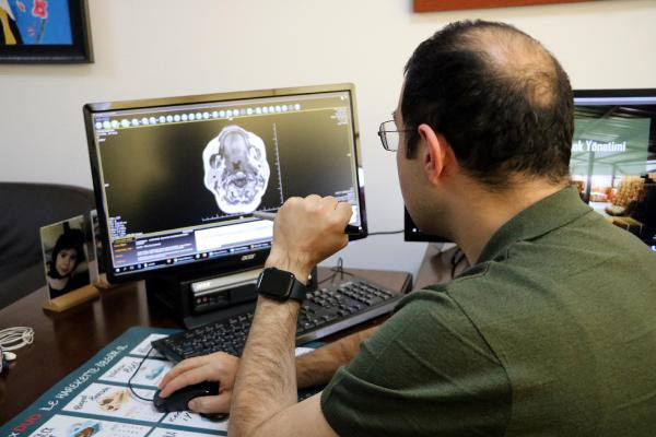 Zonguldak'ta doktorlar şaştı kaldı! Meslek hayatında ilk kez karşılaştı: Milyonda bir görülüyor - Resim: 1