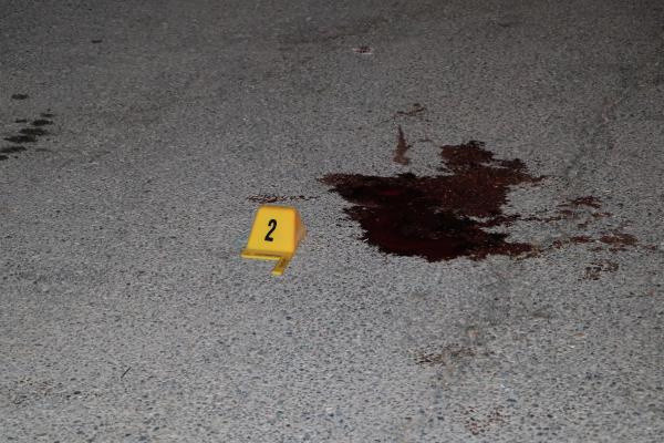 Şanlıurfa'da sokakta yürürken hayatının şokunu yaşadı! Kanlar içinde kaldı - Resim: 1