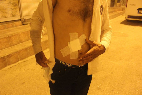 Gaziantep'te evde çay içerken kabusu yaşadı: Bir anda kıyamet koptu - Resim: 1