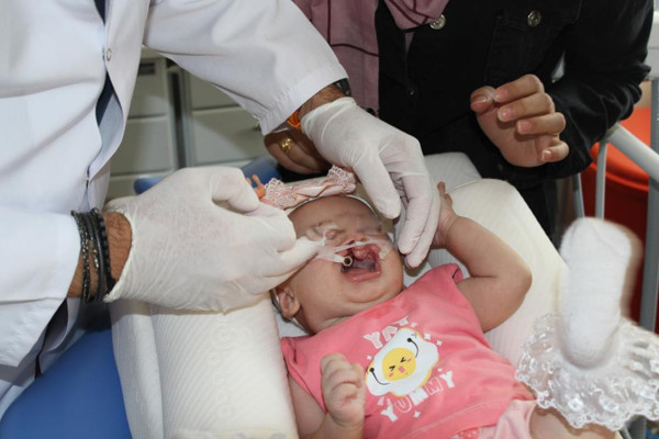 Bursa'da çift taraflı dudak-damak yarığıyla doğdu! En yüksek seviyede... - Resim: 0