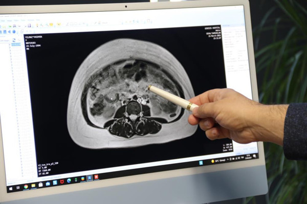 Yıllardır hamile gibi yaşıyordu! Eskişehir'de doktora gidince öğrendiği gerçekle şok oldu - Resim: 3