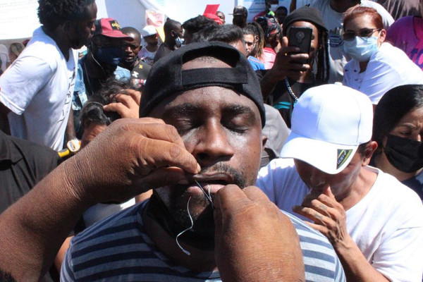 İğne iplik kullanarak ağızlarını diktiler! Açlık grevine başladılar! İlginç protesto görenleri şaşkına çevirdi - Resim: 0