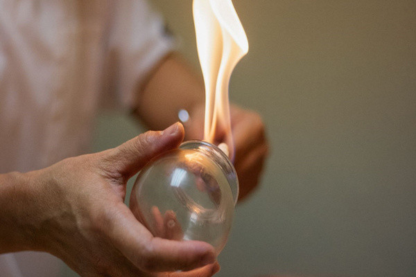 Bu şikayetleriniz varsa hacamat yaptırın! İşte her hastalığa şifa olan hacamatın mucizevi etkileri - Resim: 0