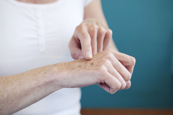 Yaşınızı yüzünü değil elleriniz ele veriyor! Bu yöntemle elinizde ne leke kalacak ne kırışık - Resim: 1