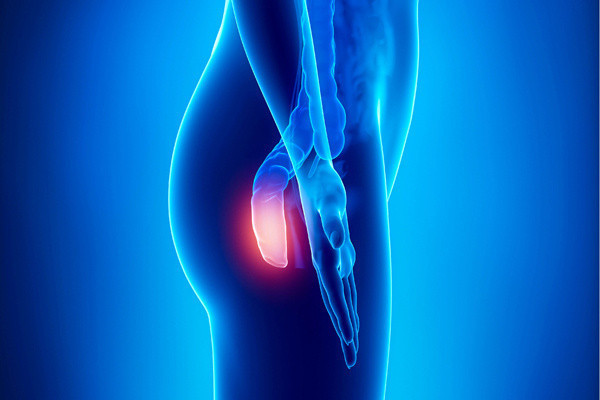 Hemoroid ile başınız dertteyse bu yöntemleri mutlaka deneyin! En etkili doğal ilaçlar - Resim: 1