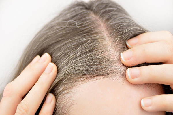 Saçlarınız beyazlıyorsa dikkat! Bu besinler sizin için hayati önem taşıyor - Resim: 0