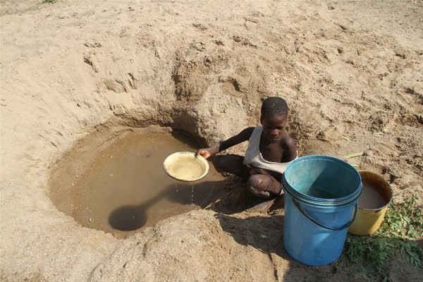Bu köyde yaşayanlar 'devekuşu' ayaklı - Resim: 2