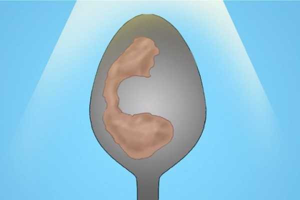 Kaşık testi ile sağlık sorunları anlaşılabilir mi? - Resim: 4