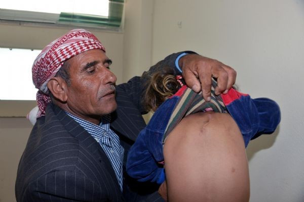 Ensesinden 3. kol çıktı! Doktorlar şoke oldu - Resim: 1