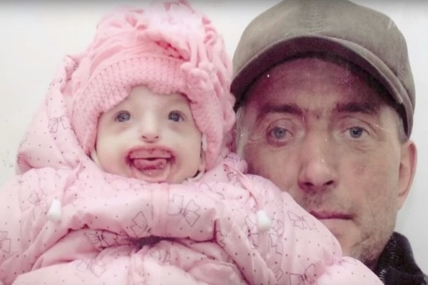 18 yıl sonra baba oldu ama bebek dünyaya gelince şoke oldular - Resim: 2