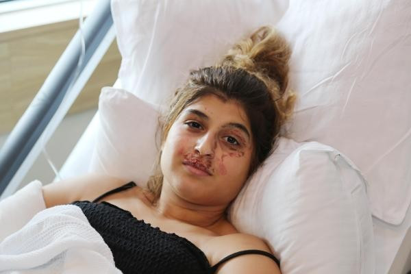 Anne-kız dehşeti yaşadı! Bakın nasıl bu hale geldiler - Resim: 1