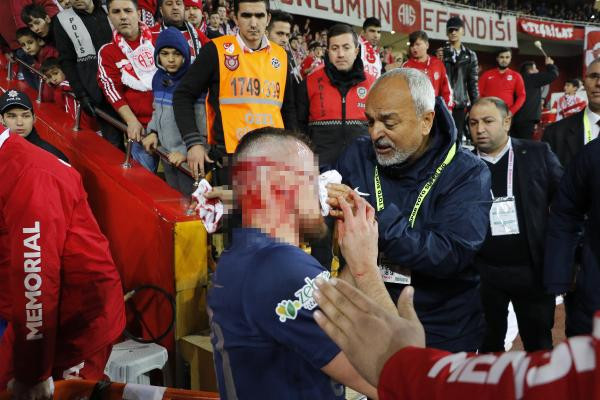 Kanlar içinde yerde kaldı! Yürekleri ağza getiren sakatlık - Resim: 2