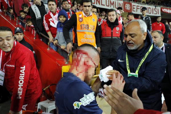 Kanlar içinde yerde kaldı! Yürekleri ağza getiren sakatlık - Resim: 3