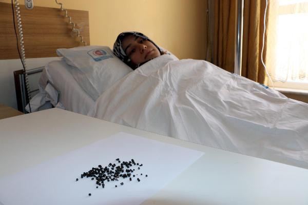 Karnından tam 200 adet taş çıktı başhekim şaşkına döndü - Resim: 1