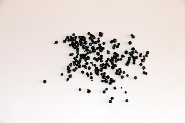 Karnından tam 200 adet taş çıktı başhekim şaşkına döndü - Resim: 2