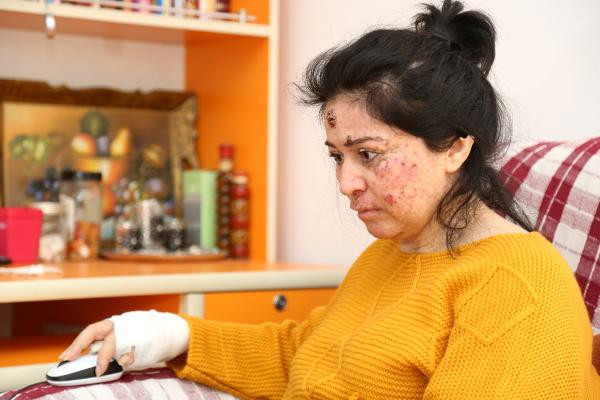 Çok nadir görülüyor! Kimse soru sormasın diye dışarı çıkamıyor - Resim: 1