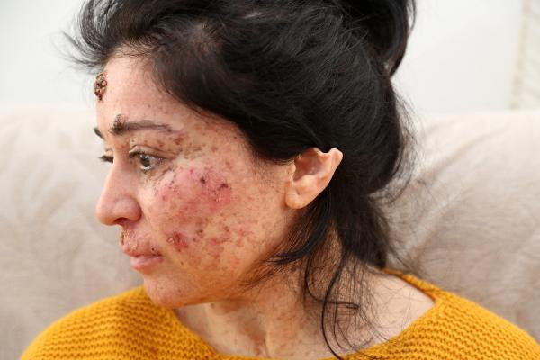 Çok nadir görülüyor! Kimse soru sormasın diye dışarı çıkamıyor - Resim: 4