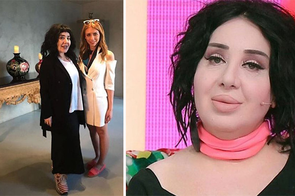 Nur Yerlitaş'ı görenler şoke oldu zayıfladı zayıflamasına ama... - Resim: 3