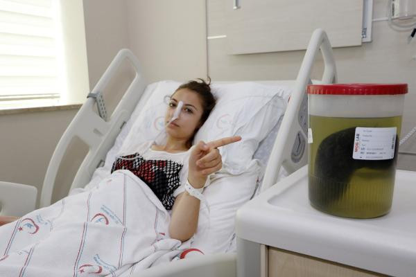 Karın ağrısıyla gitti: Hasta da doktor da gözlerine inanamadı! - Resim: 3