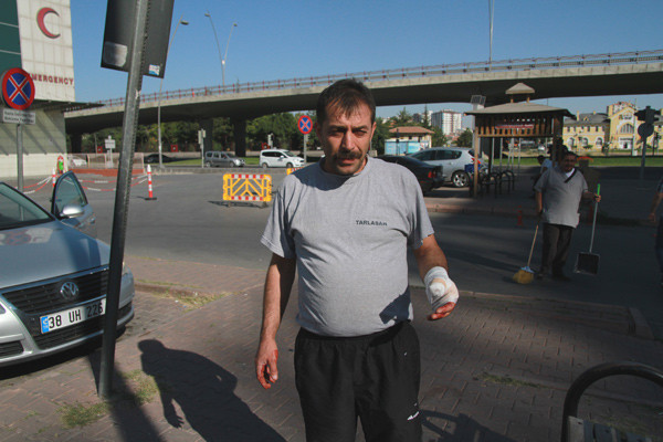 Acemi kasaplar işbaşında! Rezil olmamak için bakın ne dediler - Resim: 1