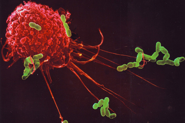 Kuşburnu 'c vitamini'nin en zengini! Bununla da bitmiyor... - Resim: 4