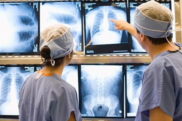 Bu 7 davranış akciğerinizi bitiriyor! - Resim: 3