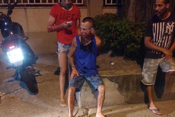 Kendisini gasp etmek isteyen adamı tanınmaz hale getirdi - Resim: 2