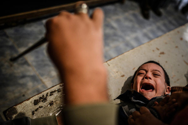 Mısır'da bal arısıyla acı dolu tedavi - Resim: 3