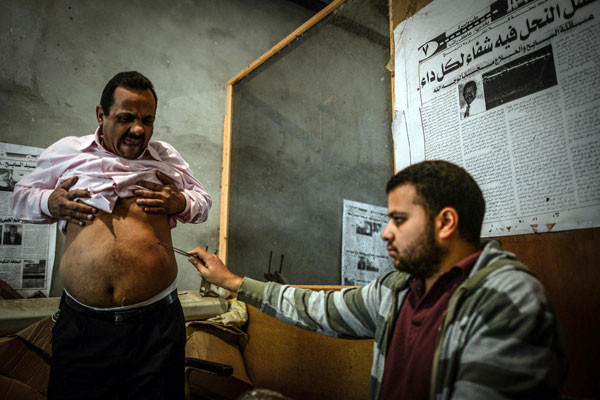 Mısır'da bal arısıyla acı dolu tedavi - Resim: 4