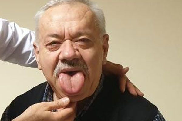 Giresun'da akılalmaz olay dili ve elleri her geçen gün büyüyor - Resim: 1